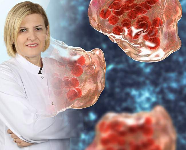 Lösemi hakkında bilinmesi gereken 8 önemli nokta!
