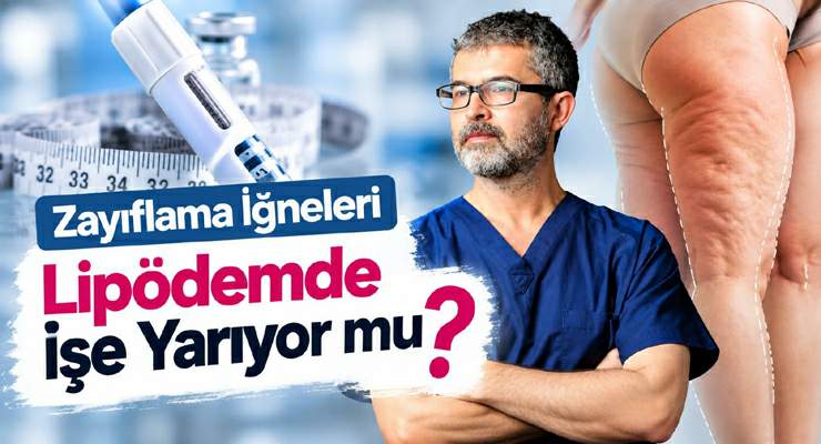 Prof. Dr. Ahmet Karacalar, “Zayıflama iğneleri lipödemde işe yarıyor mu?”