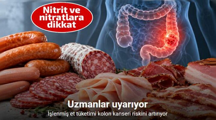 Profesör açıkladı: “İşlenmiş et tüketimi kolon kanseri riskini artırıyor”