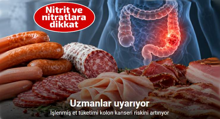 Profesör açıkladı: “İşlenmiş et tüketimi kolon kanseri riskini artırıyor”